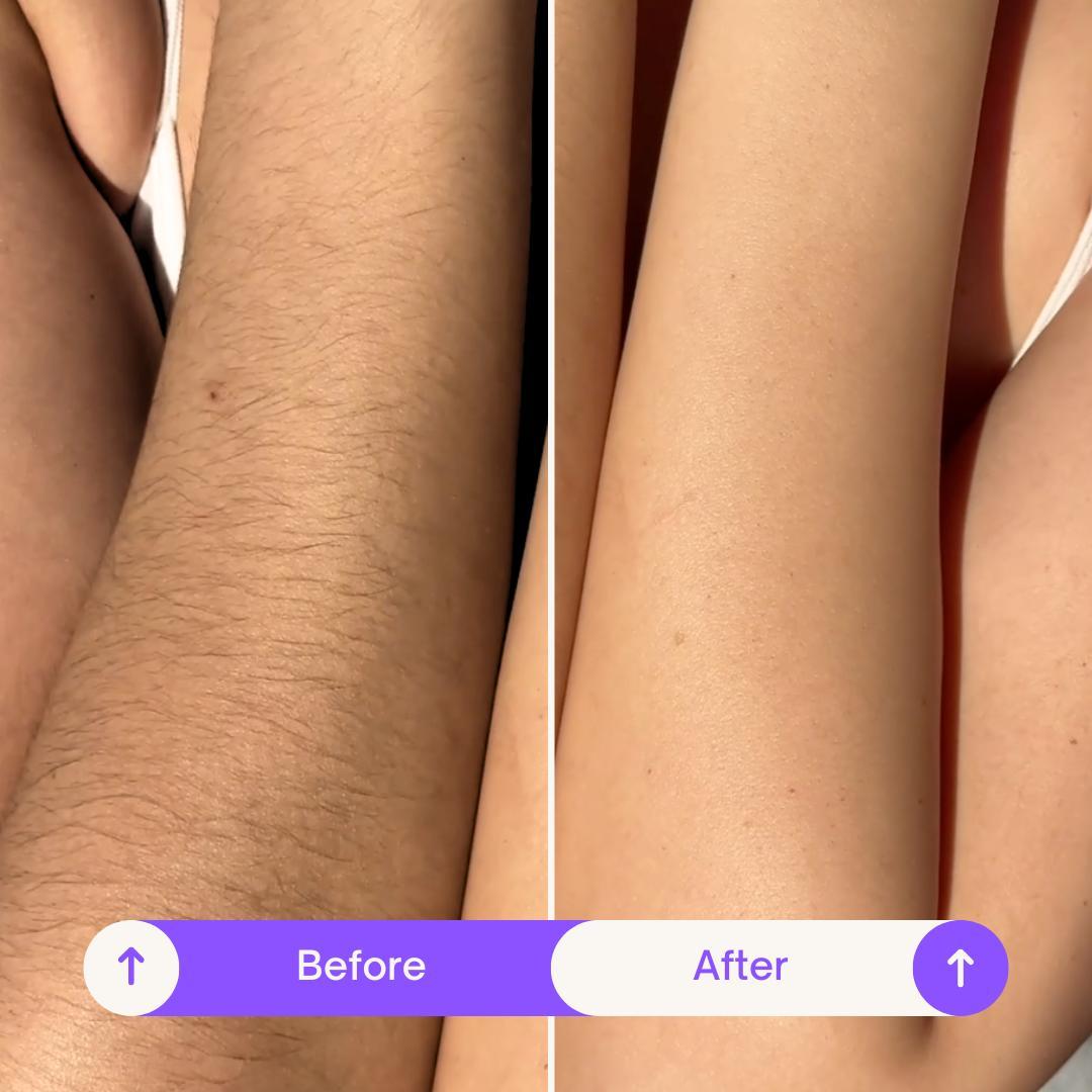 Sensitive Body Hair Removal Cream with Shea Butter for Smooth, Comfortable Skin