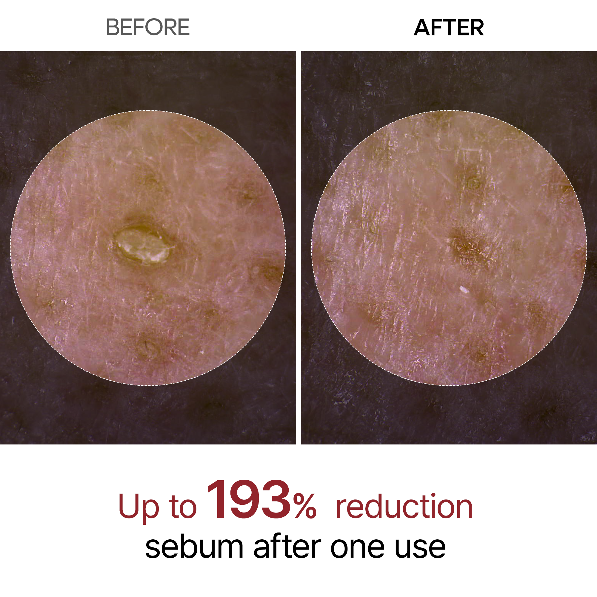 Dr Melaxin Peel Shot Glow Black Rice Ampoule for Pore Care & Smooth Skin Texture