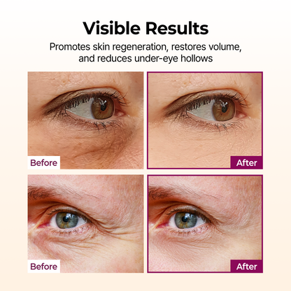 Dr Melaxin Calcium Volume Multi Balm for Under Eye, Dark Circles & Fine Lines