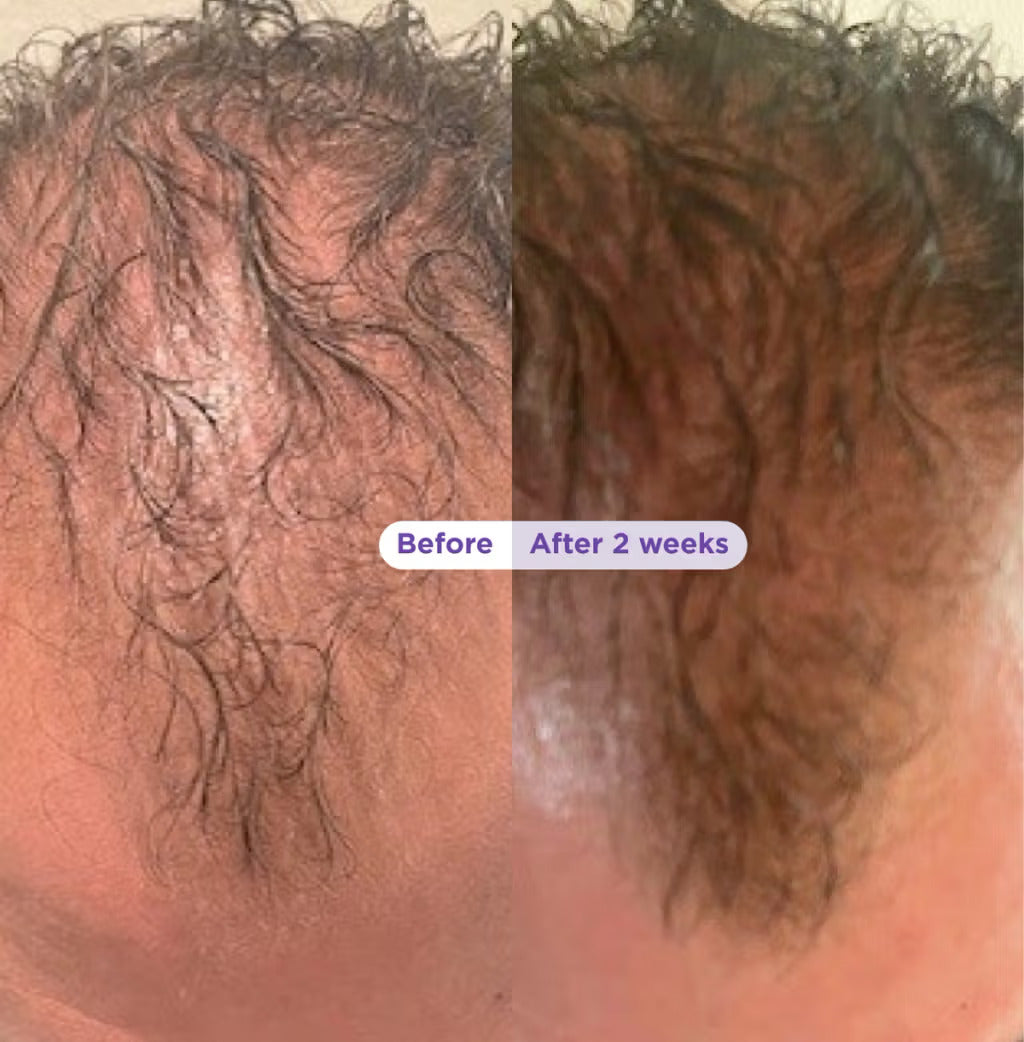 Biotin & Rosemary Thickening Shampoo & Conditioner Set for Fuller, Thicker-Looking Hair