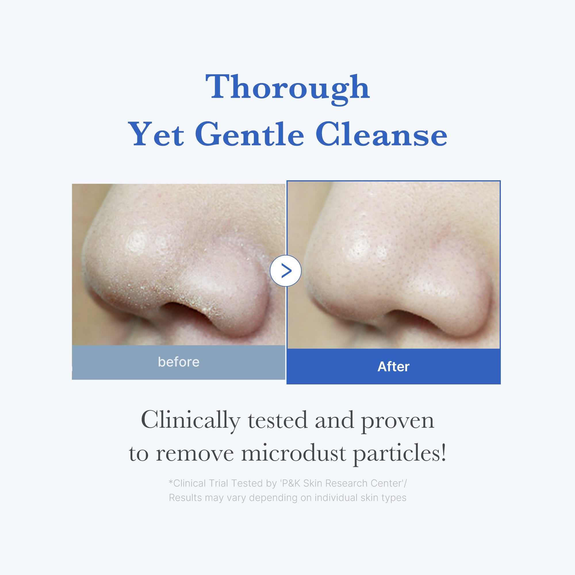 Zero Foam Cleanser with Salicylic Acid for Pore Care & Oil Control
