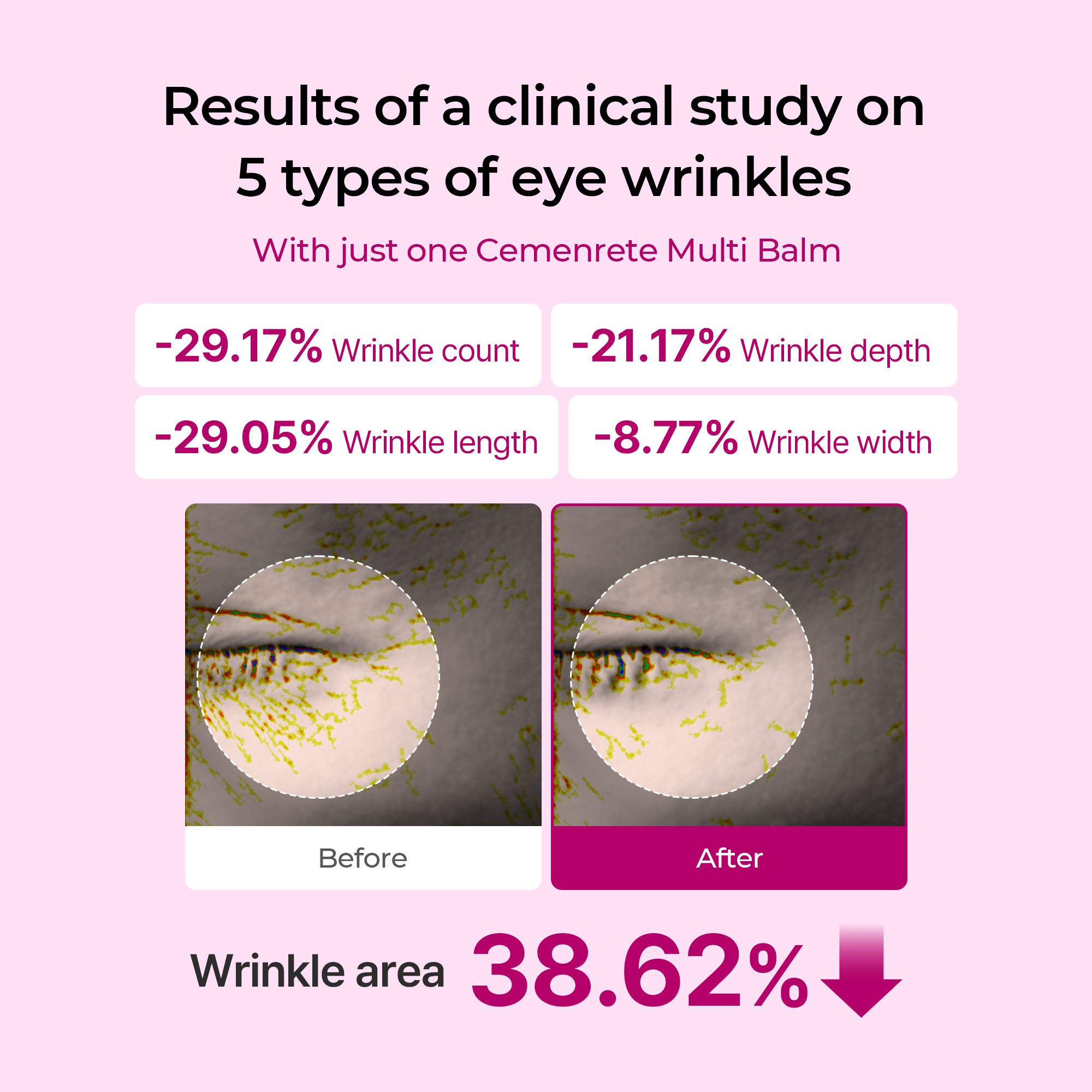 Collagen Boost Eye Care Set with Collagen, Calcium & Elastin for Firming & Hydration