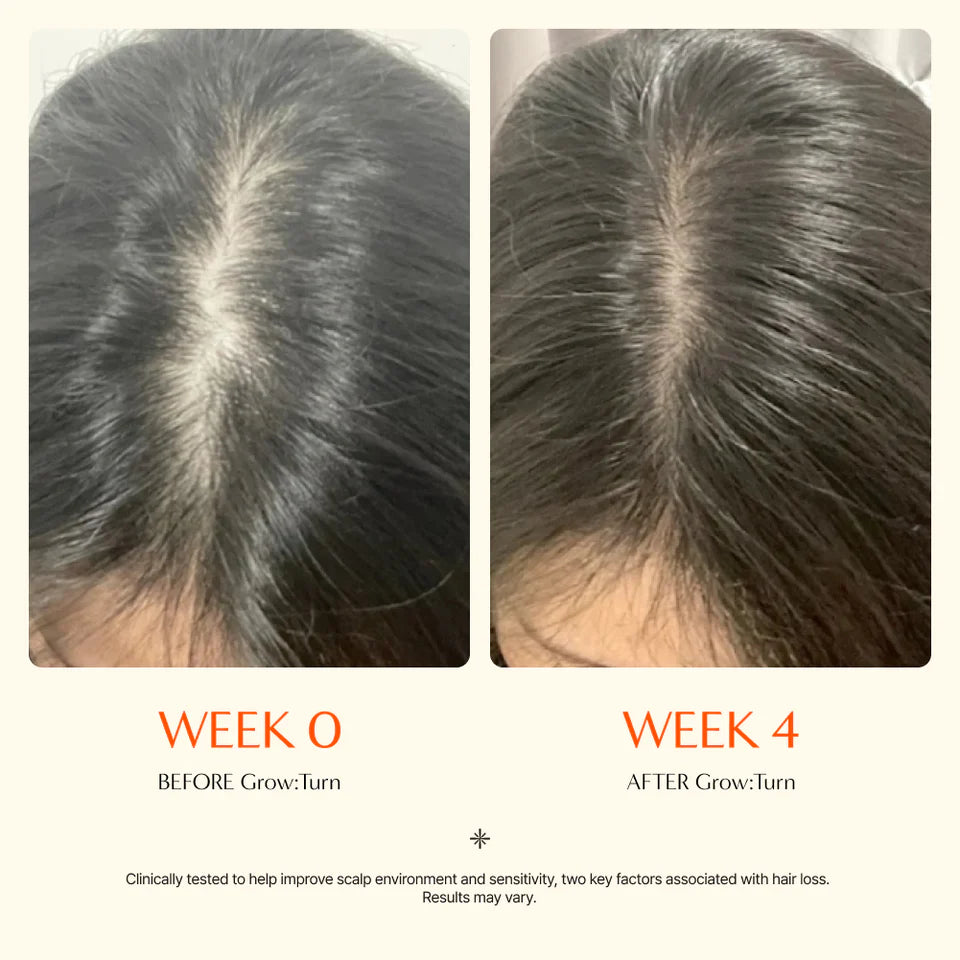Growturn Hair Serum with Brush 100ml – Scalp Serum for Thinning and Fuller-Looking Hair