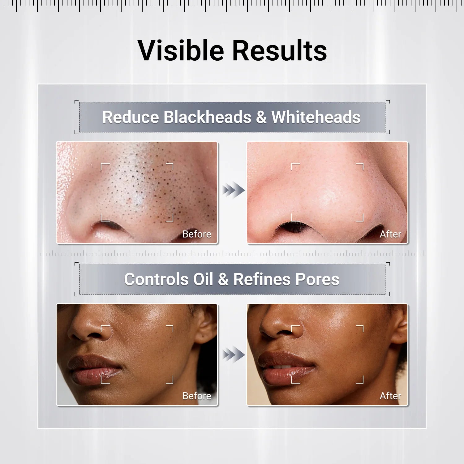 Volcano Cleansing Clay Stick with Charcoal for Pores and Blackheads