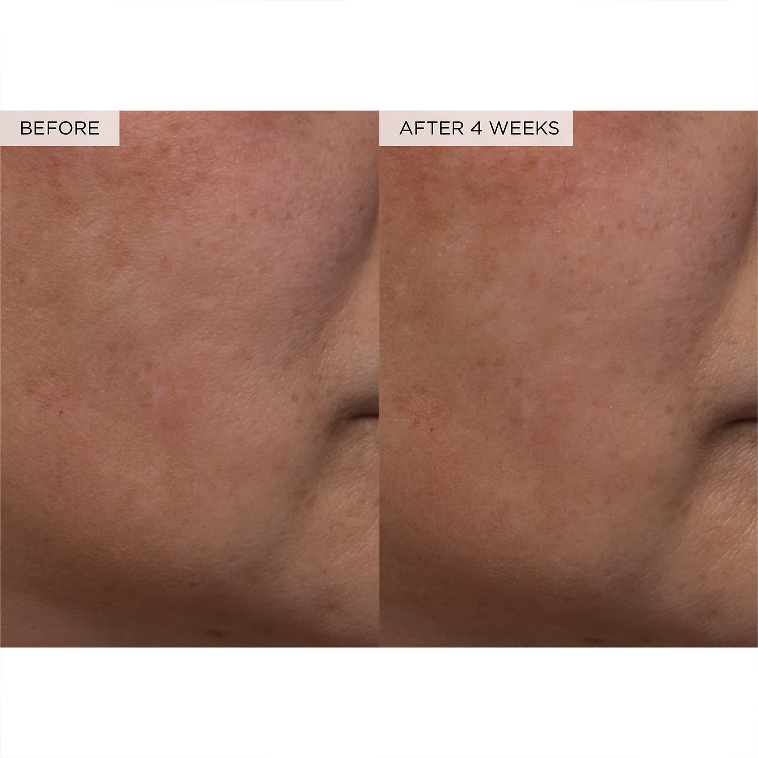 PHA + BHA Pore Tight Toner for Pores, Oily Skin & Texture