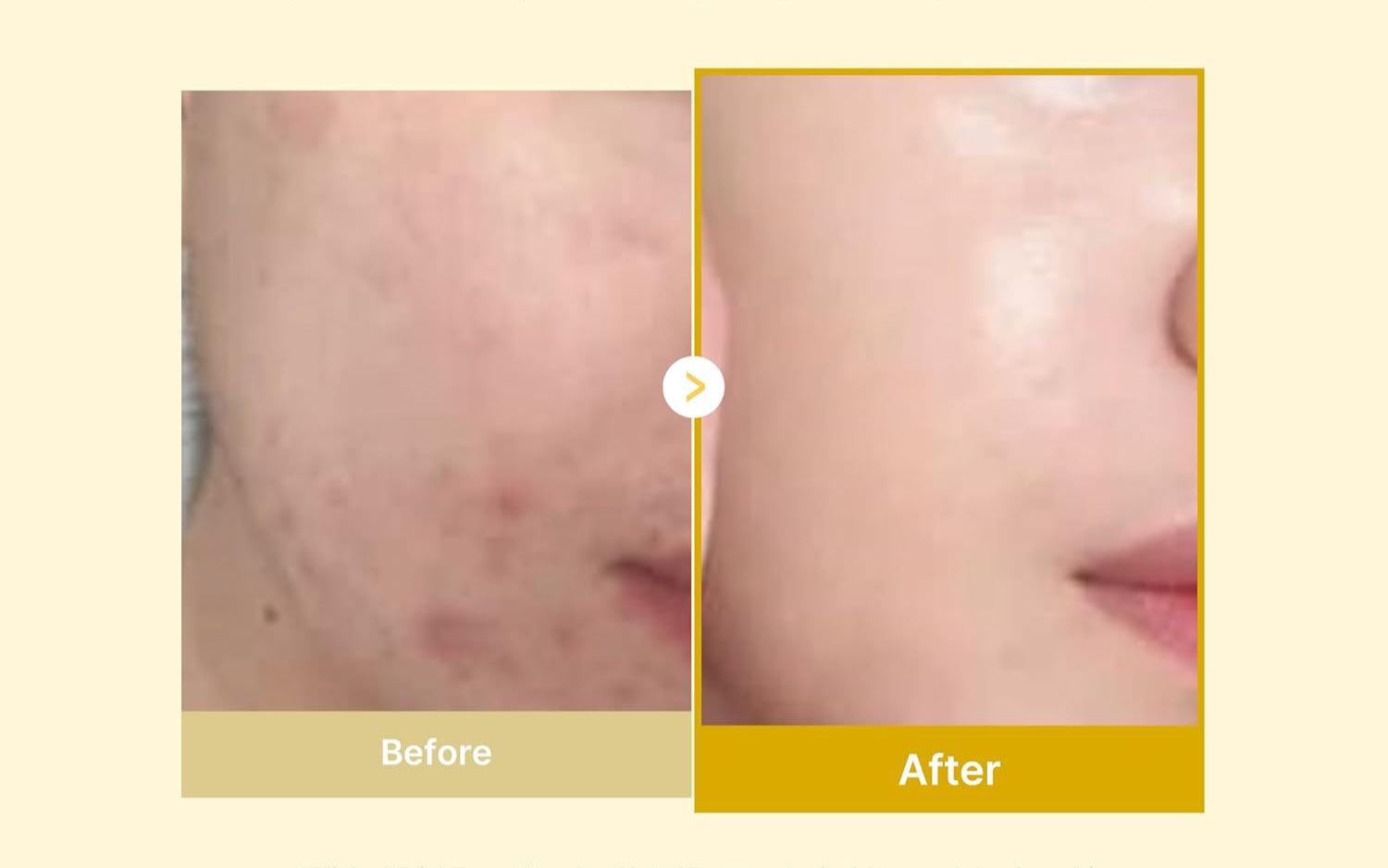 Kojic Acid Turmeric Night Mask with Vitamin C & Retinol for Glowing Skin