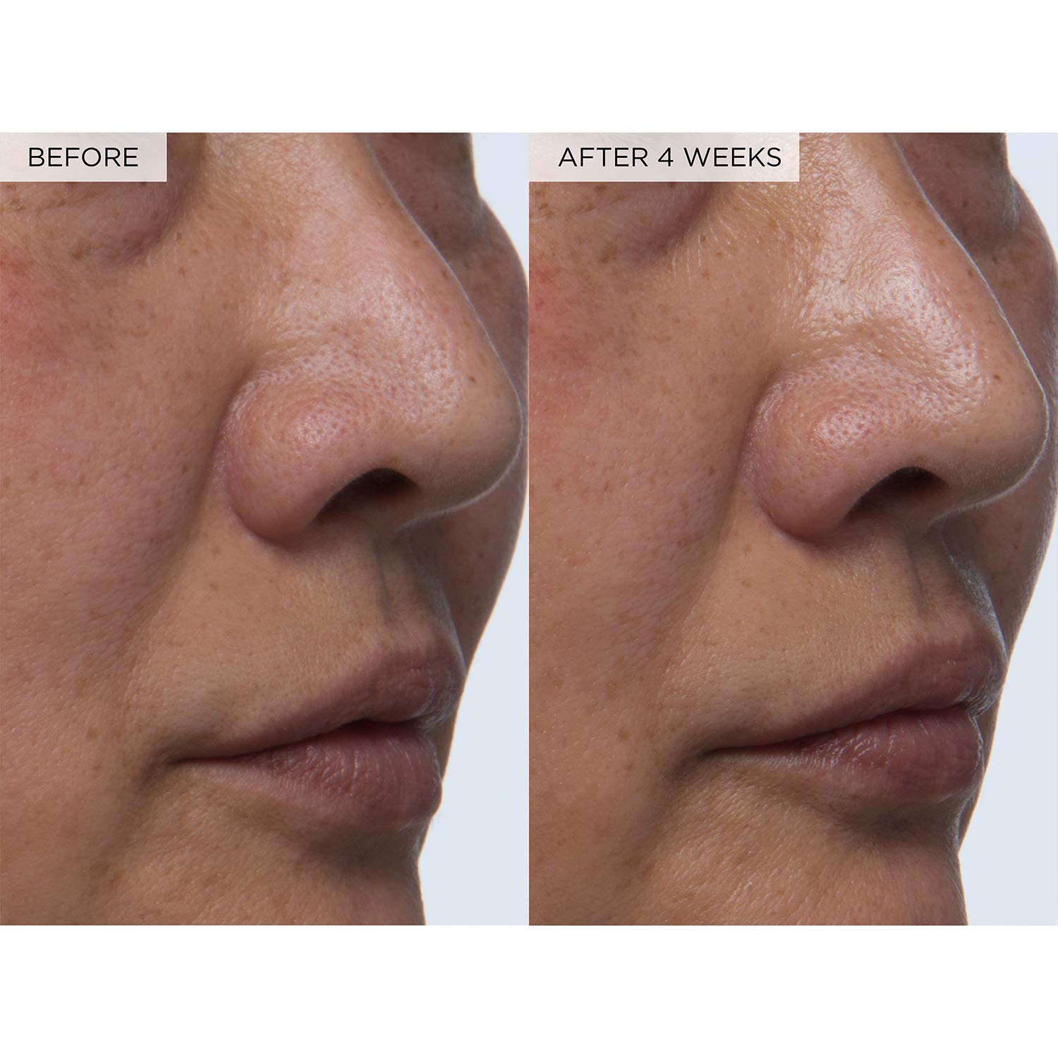 PHA + BHA Pore Tight Toner for Pores, Oily Skin & Texture