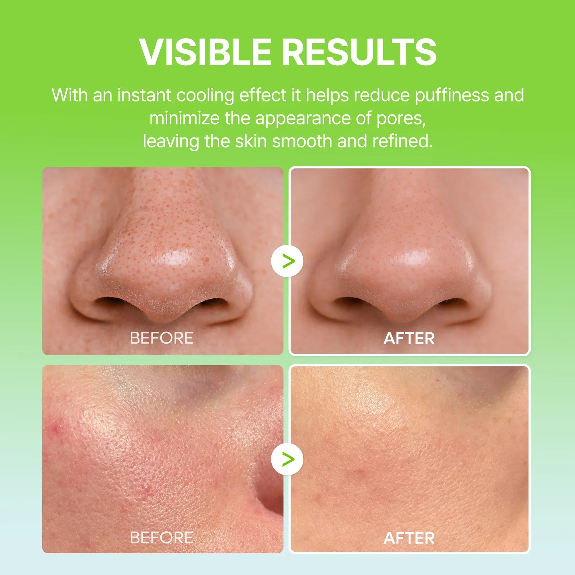 CACTOX Pore Relief Multi Balm for Pores, Puffiness & Texture