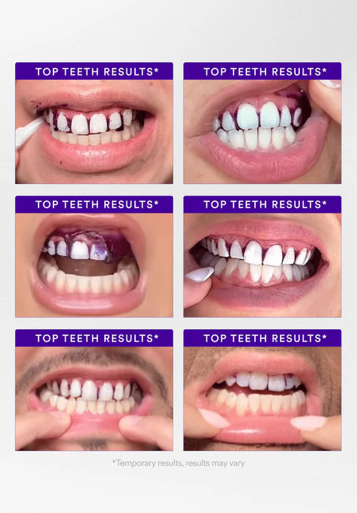 Whitening Strips and Whitening Mouthwash Starter Bundle for Teeth Whitening and Fresh Breath