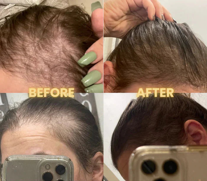 Scalp Stimulator Hair Growth Oil for Hair Thinning and Fuller-Looking Hair