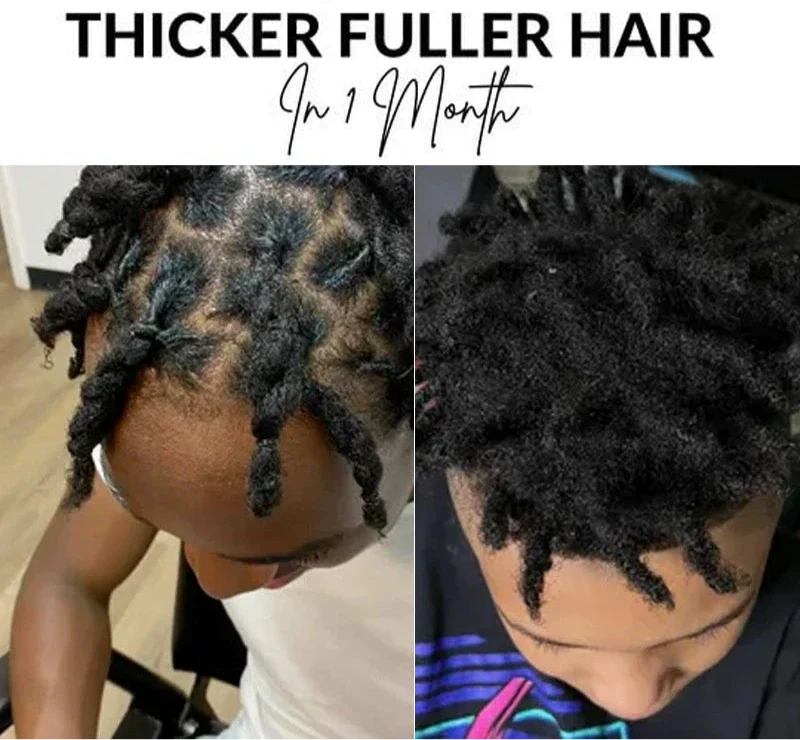 Scalp Stimulator Hair Growth Oil for Hair Thinning and Fuller-Looking Hair