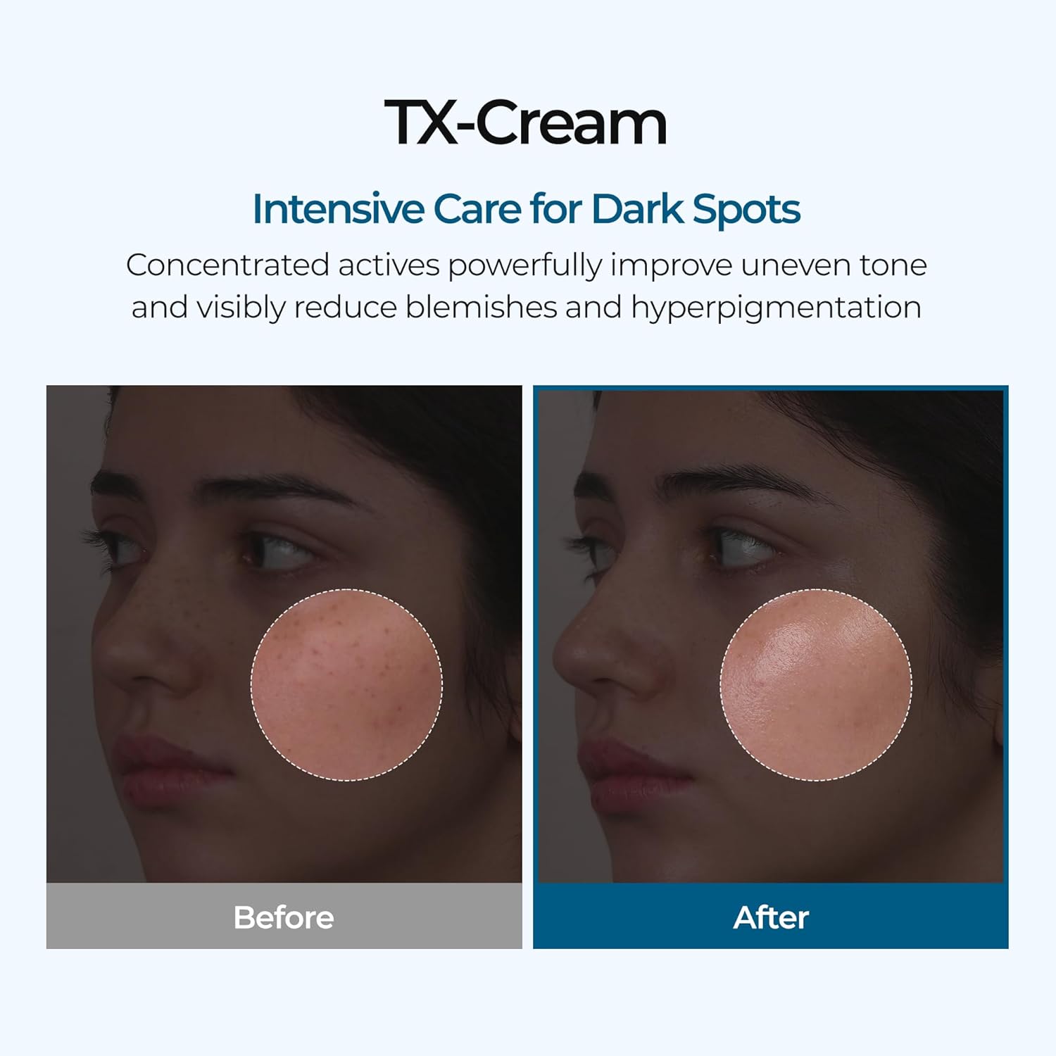 TX Tranexamic Acid Cream with Niacinamide for Dark Spots & Uneven Skin Tone