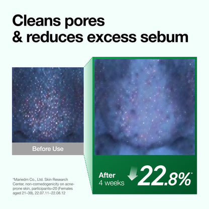 Double Cleansing Duo Set with Cleansing Oil & Salicylic Acid Foam Cleanser