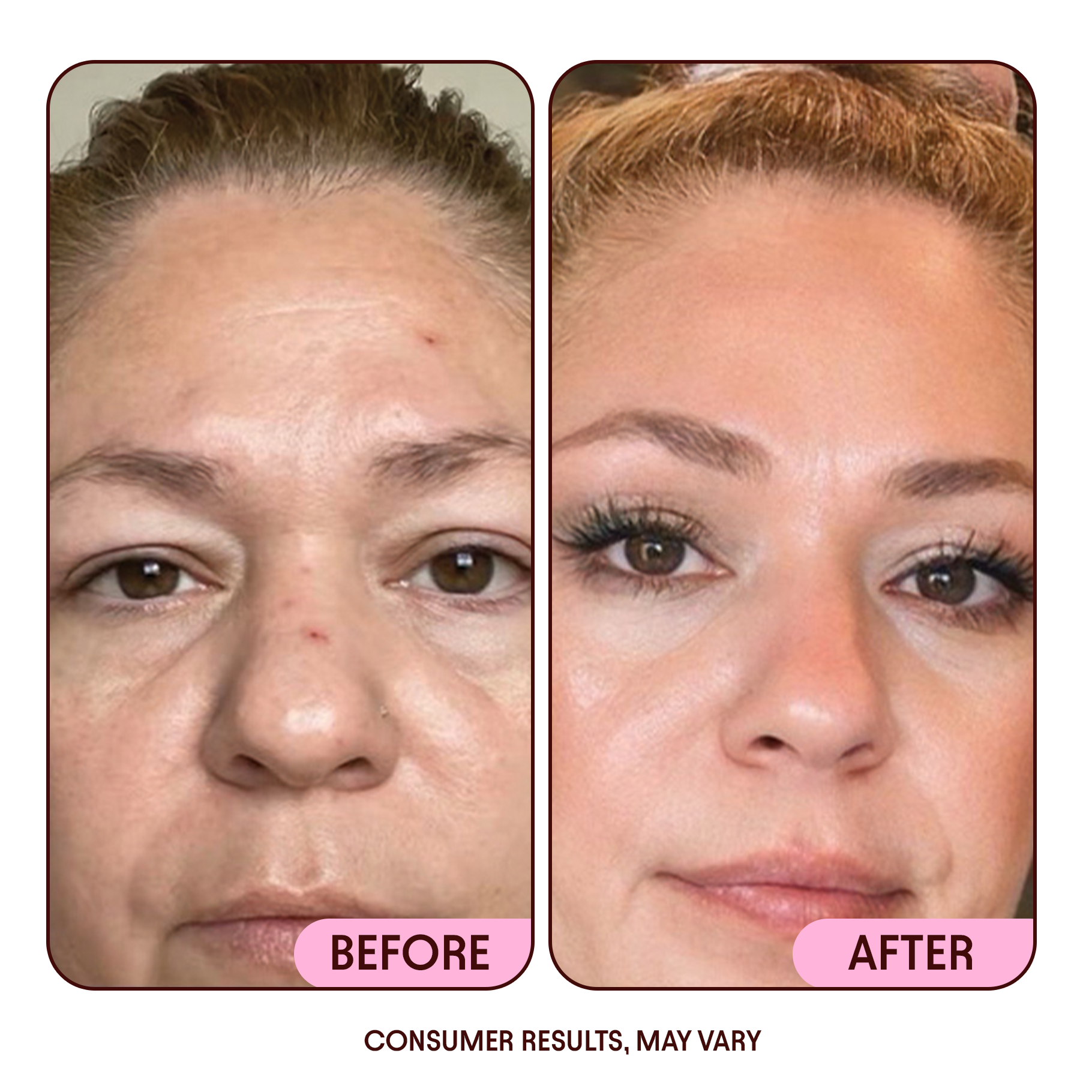Anti-Aging Moisturizing Cream with NAD+ for Wrinkles and Dark Spots