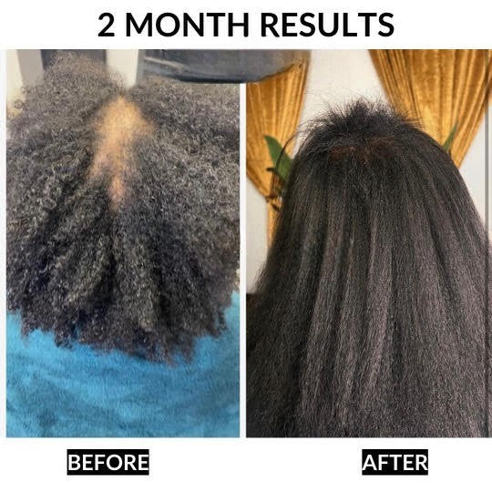 Healthy Hair Starter Kit for Hair Growth, Thinning Hair & Stronger Hair