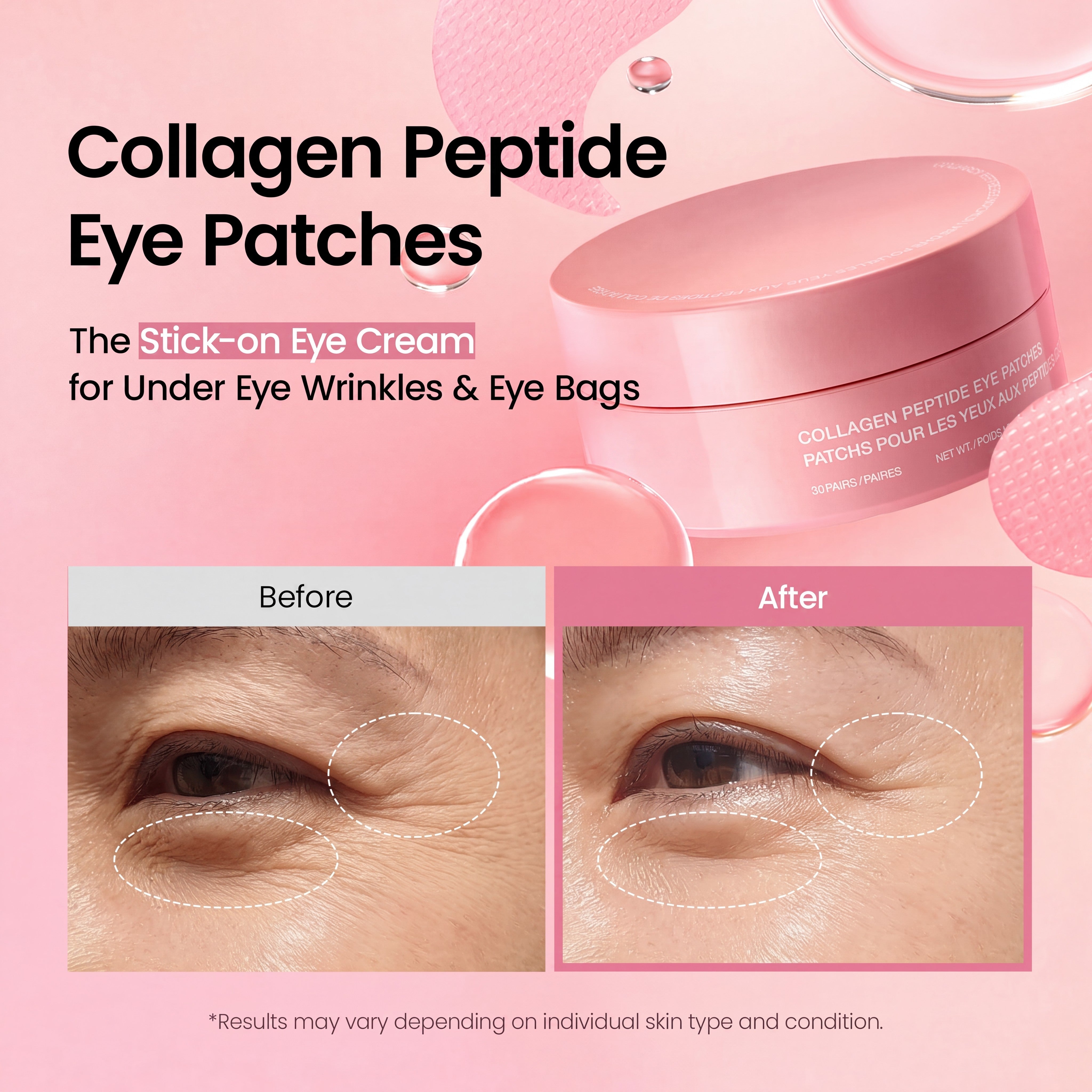 Collagen Peptide Eye Patches – Korean Skincare with Caffeine for Under Eye Bags and Puffiness